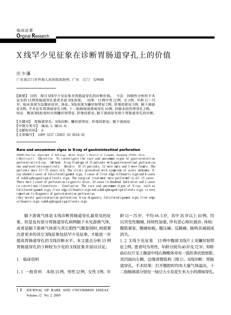 膈下游离气体是X线诊断胃肠道穿孔最常见的征_第1页