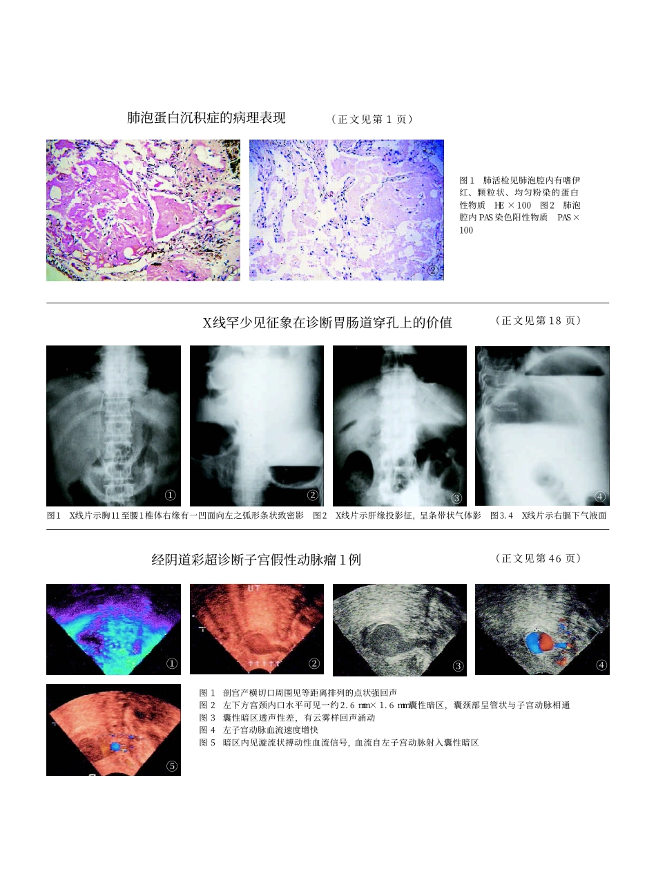 膈下游离气体是X线诊断胃肠道穿孔最常见的征_第3页