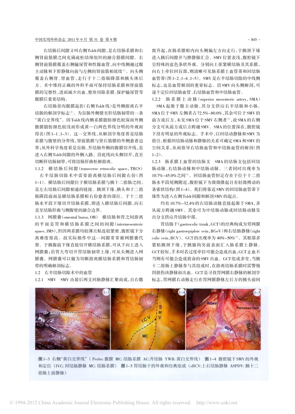 腹腔镜结直肠癌根治术解剖概要_第2页