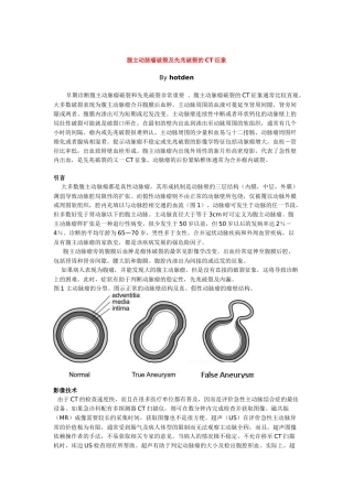 腹主动脉瘤破裂及先兆破裂的CT征象