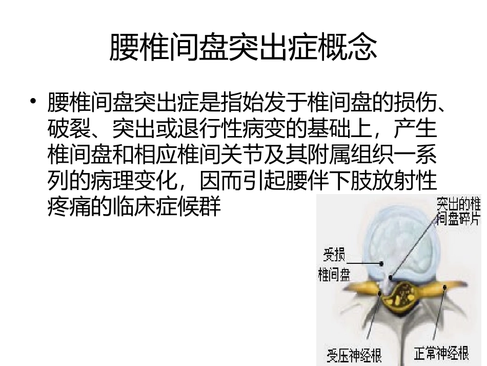 腰突症的针刀精准诊疗_第2页
