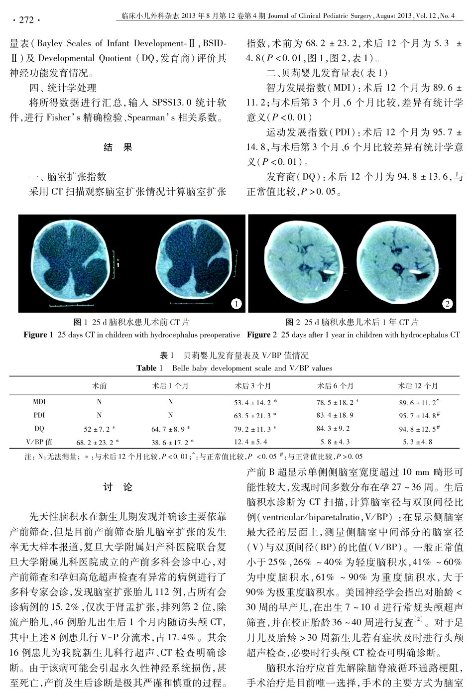 脑室-腹腔分流术治疗新生儿脑积水及预后评价 271-273_第2页