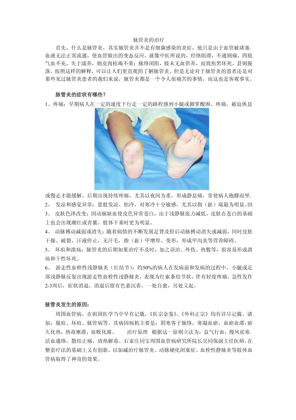 脉管炎的症状_第1页