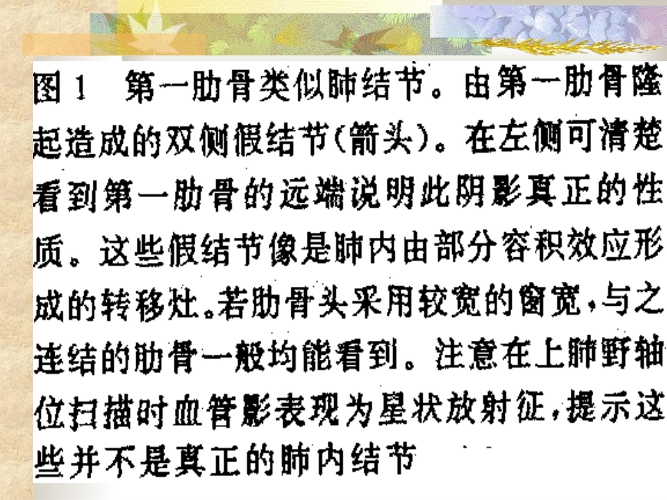 胸部正常变异_第2页