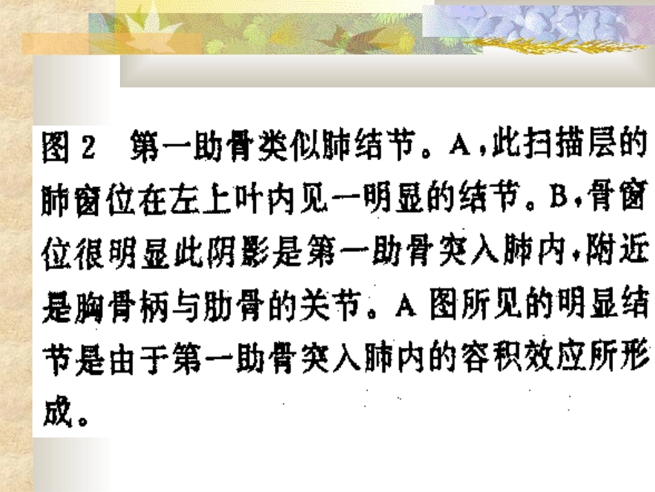 胸部正常变异_第3页