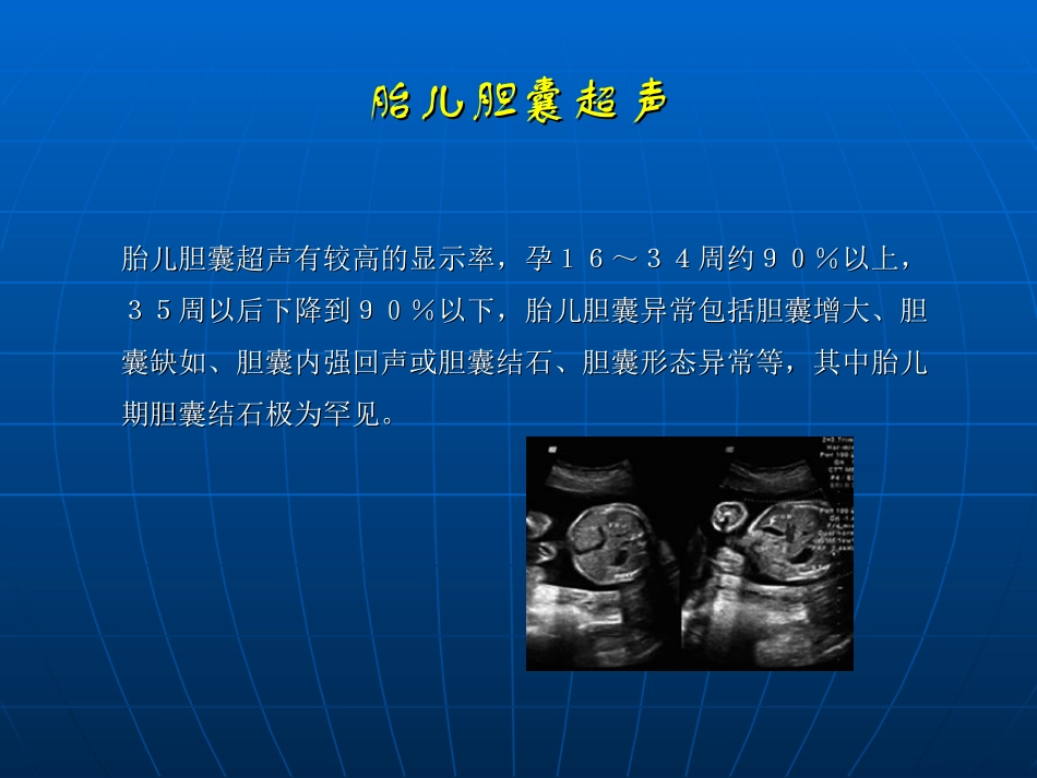 胎儿胆囊超声观察_第3页
