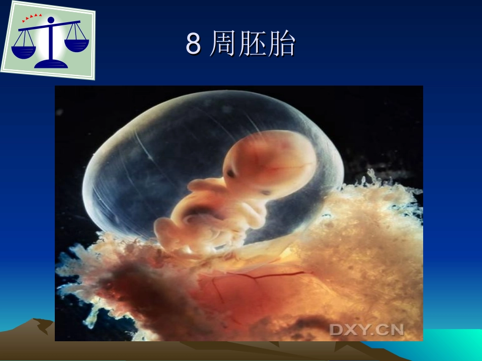 胎儿生长受限的诊疗_第3页