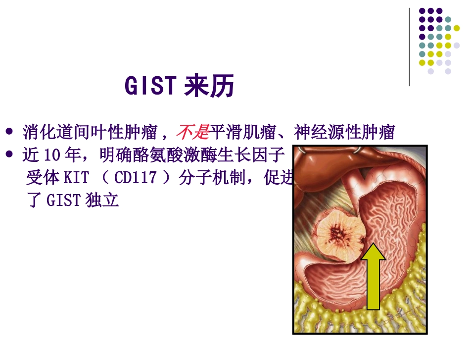 胃肠间质瘤(GIST)_第3页