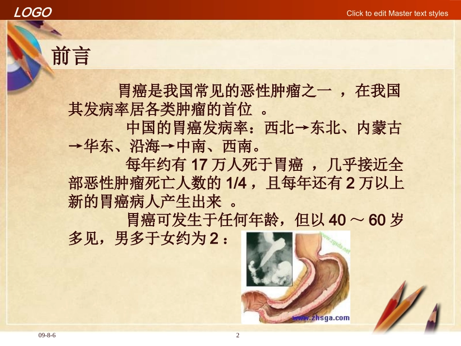 胃癌根治术后胃瘫综合征_第2页