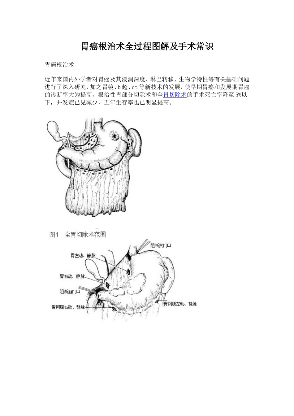 胃癌根治术全过程图解及手术常识_第1页