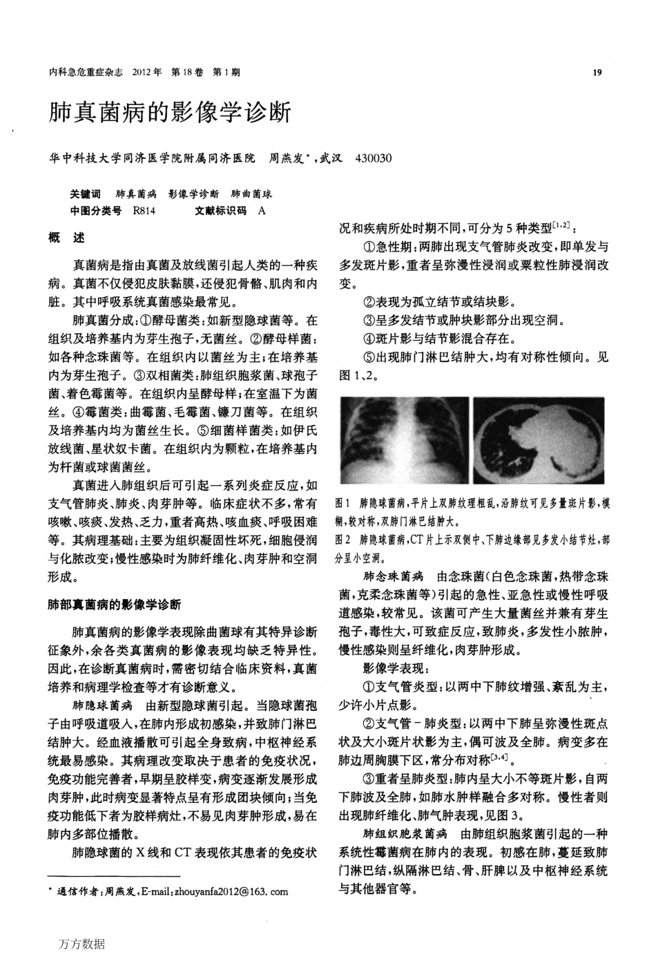 肺真菌病的影像学诊断_第1页