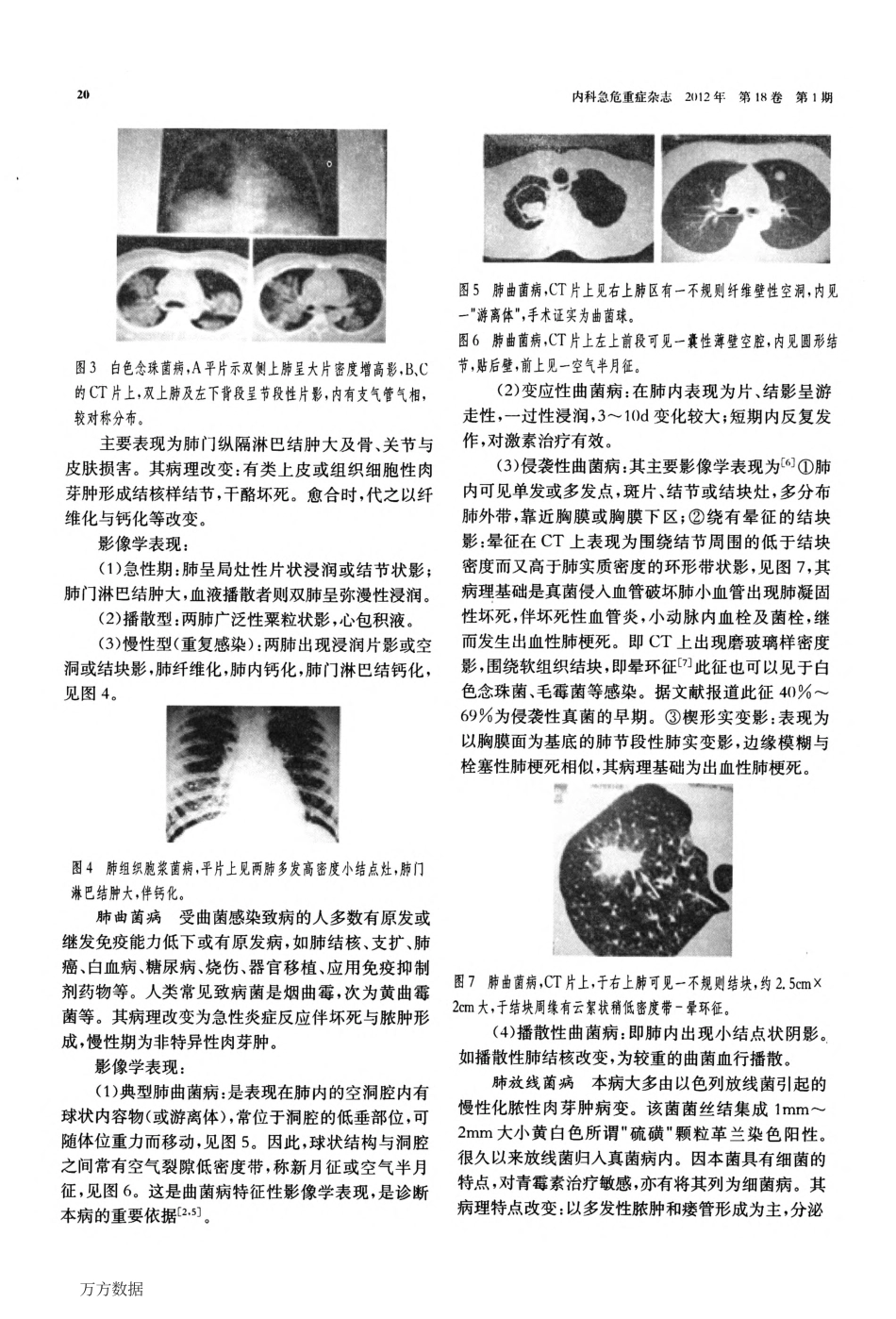 肺真菌病的影像学诊断_第2页