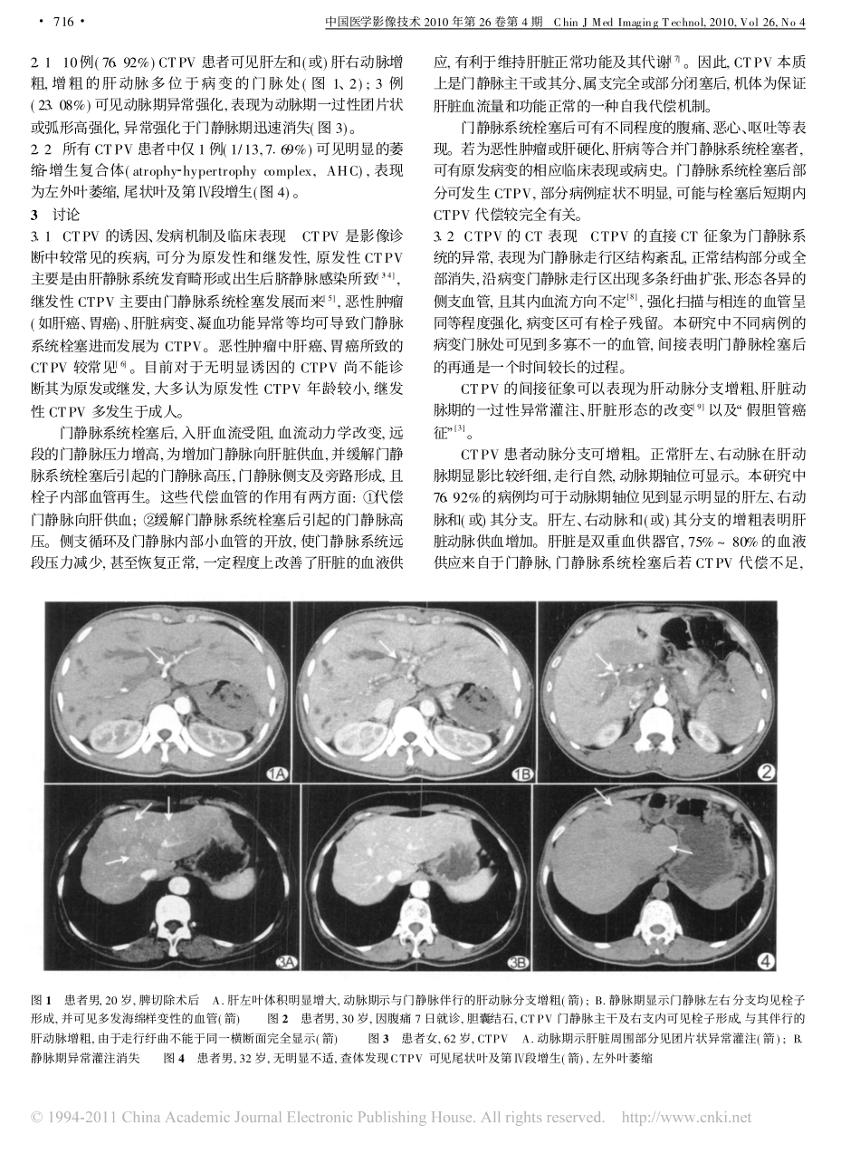 肝门静脉海绵样变性的CT特点_第2页