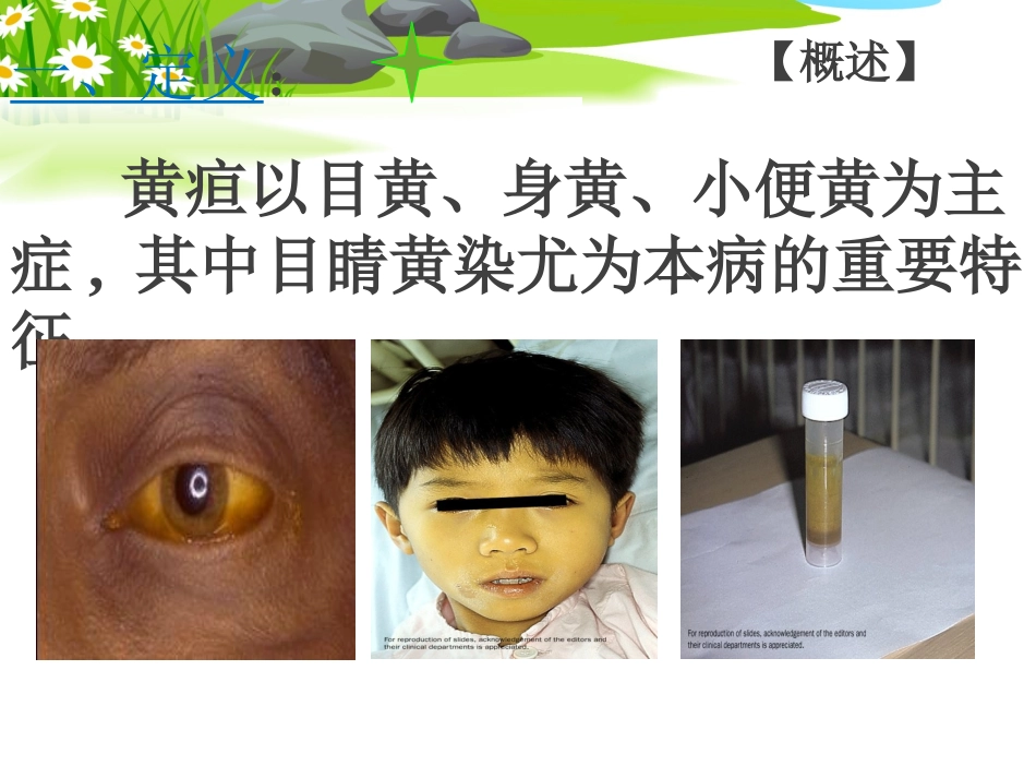 肝胆病证 黄疸_第3页