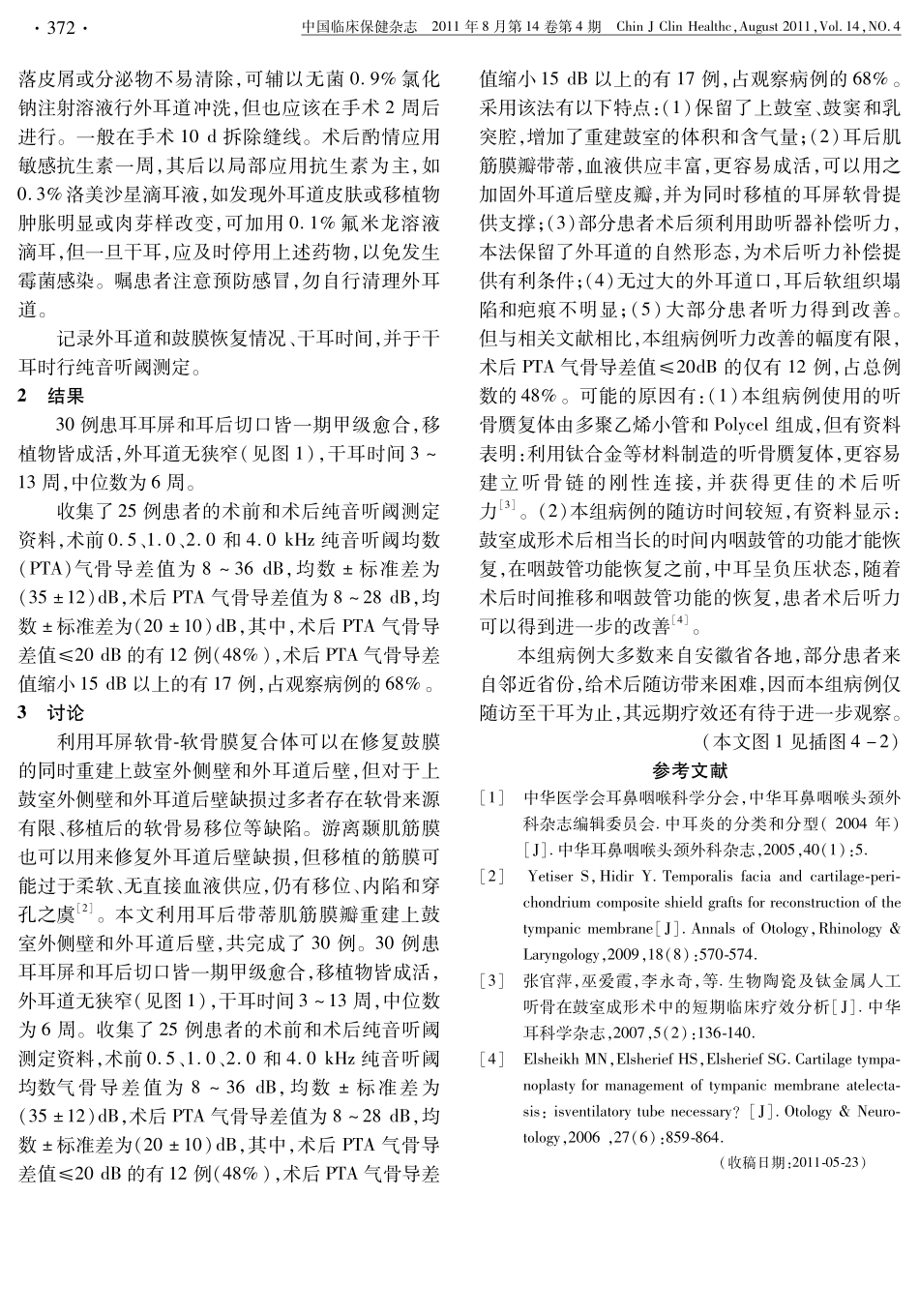 耳后带蒂肌筋膜瓣和耳屏软骨-软骨膜复合体在伴有开放式乳突根治Ⅲa型鼓室成形术中的应用_第3页