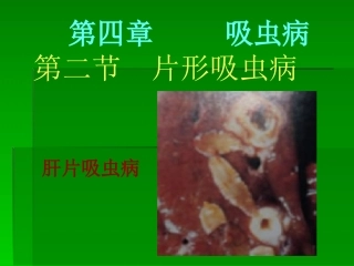 第二节  肝片吸虫病