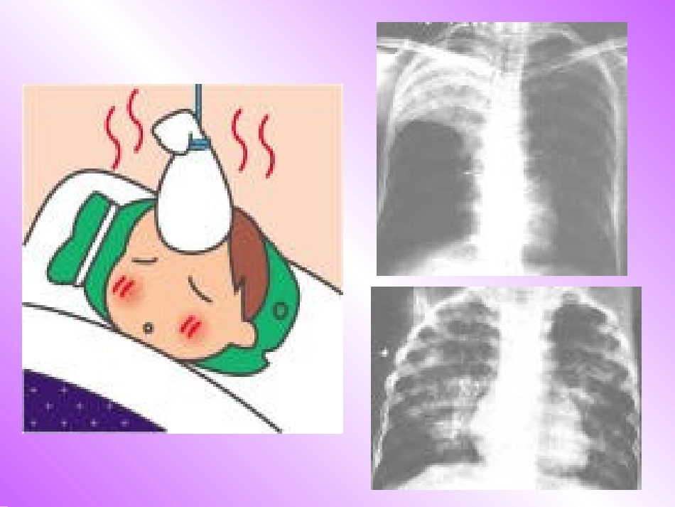 细菌和真菌的分布_第2页