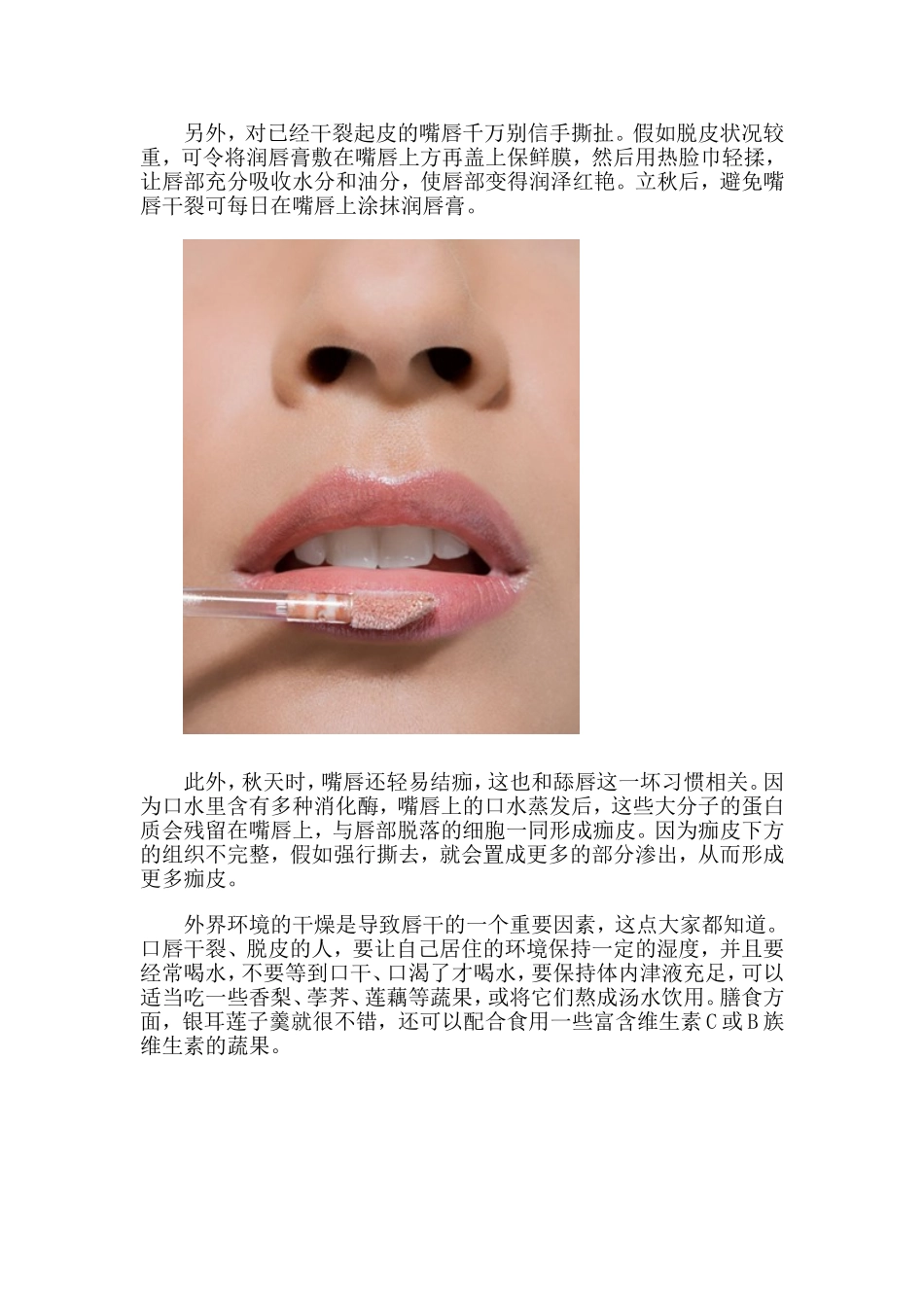 秋季嘴唇干裂应该怎么预防_第2页