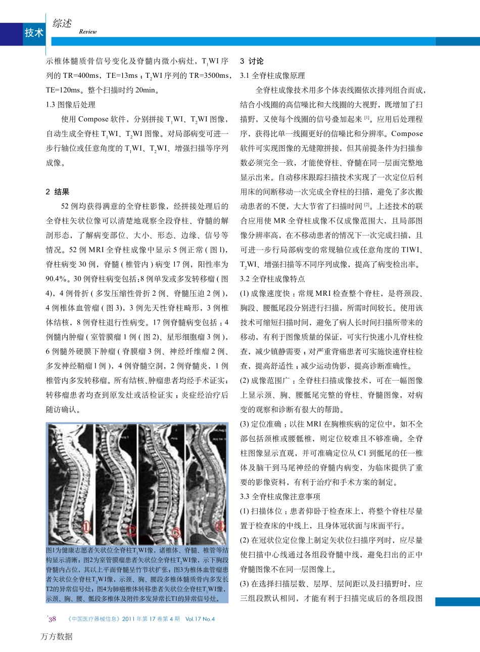 磁共振全脊柱成像技术与临床应用_第2页