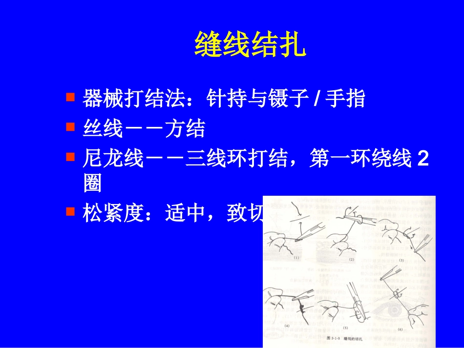 眼科显微手术器械及基本技能_第3页