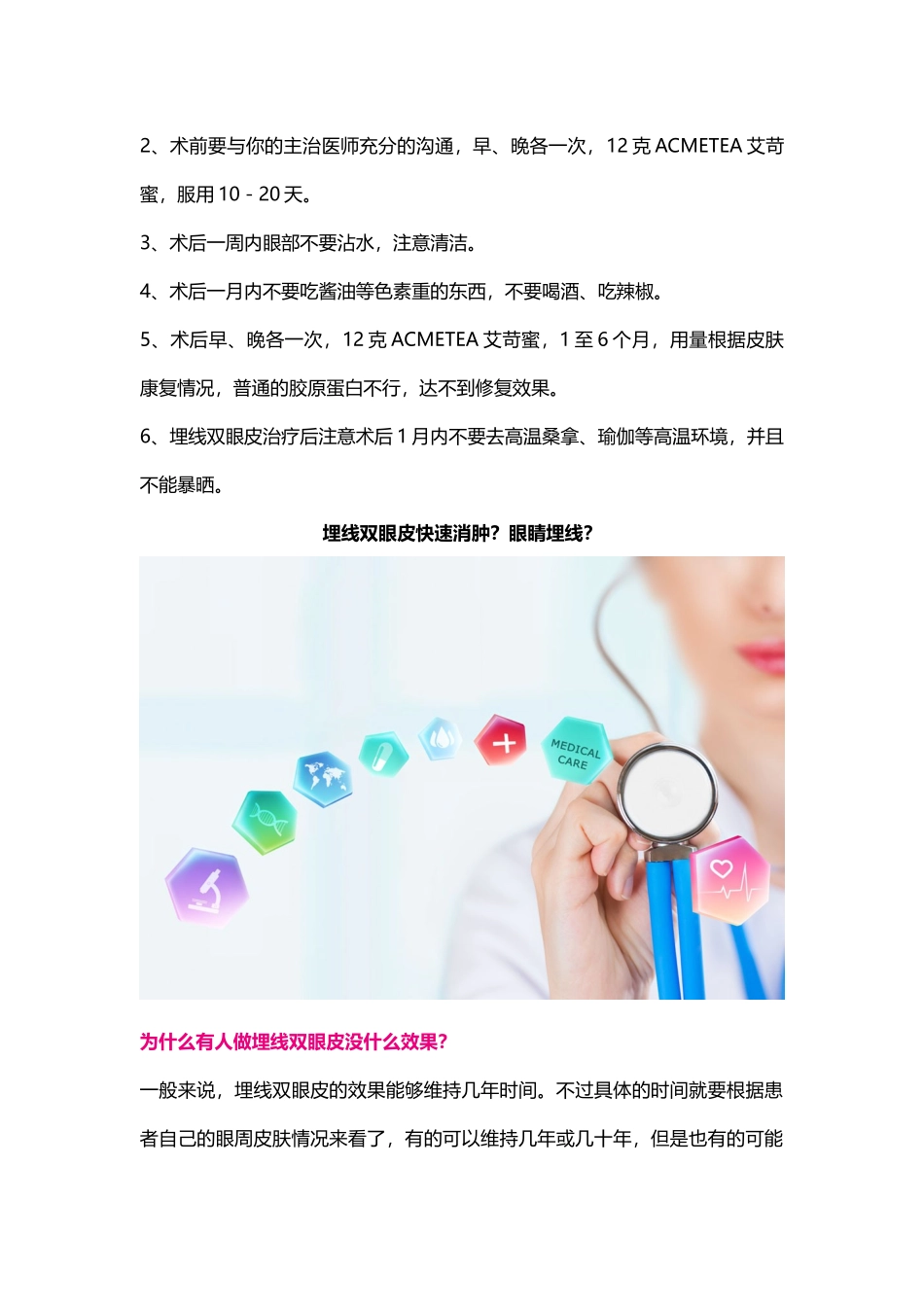 眼睛埋线？埋线双眼皮快速消肿？_第2页