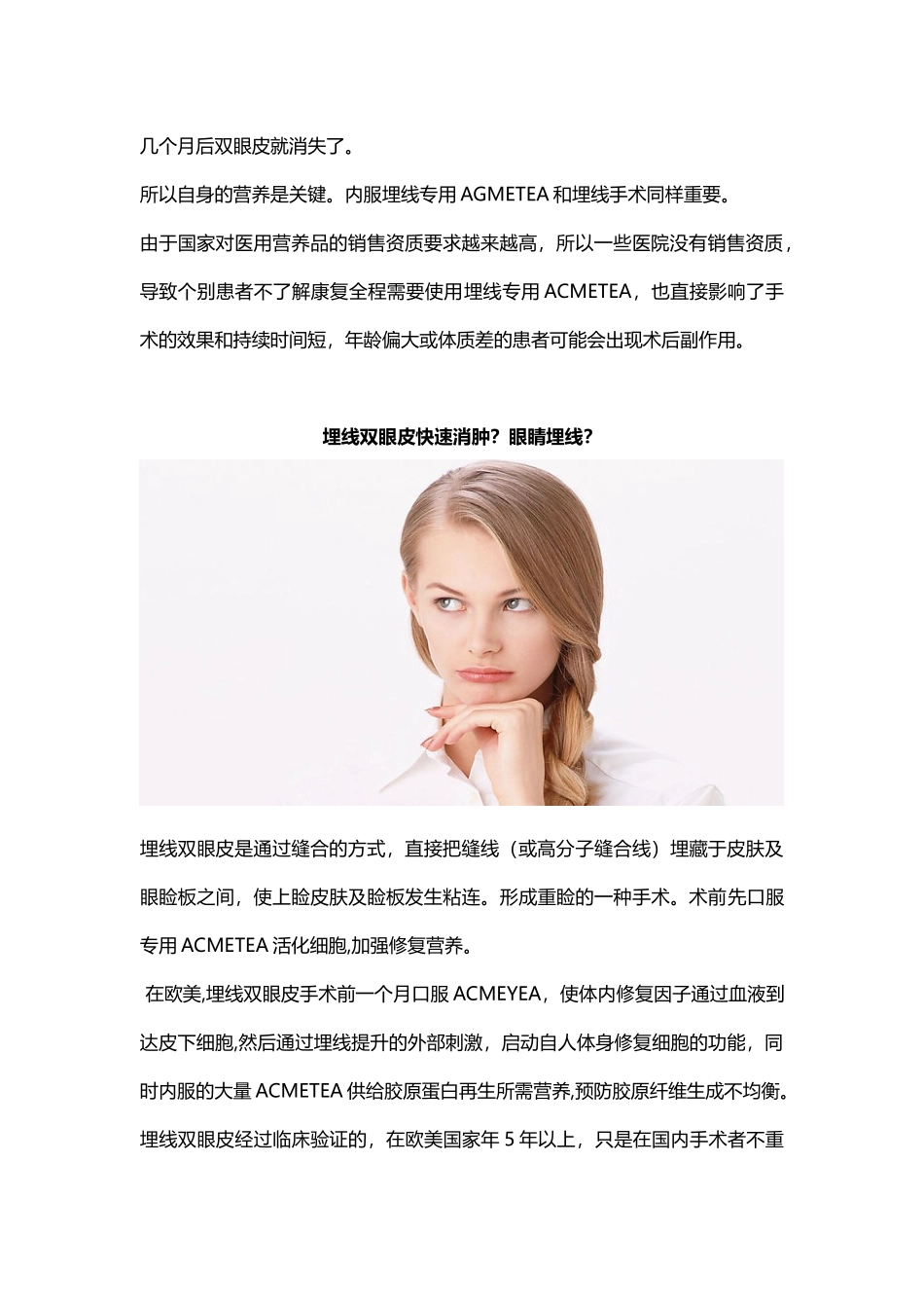 眼睛埋线？埋线双眼皮快速消肿？_第3页