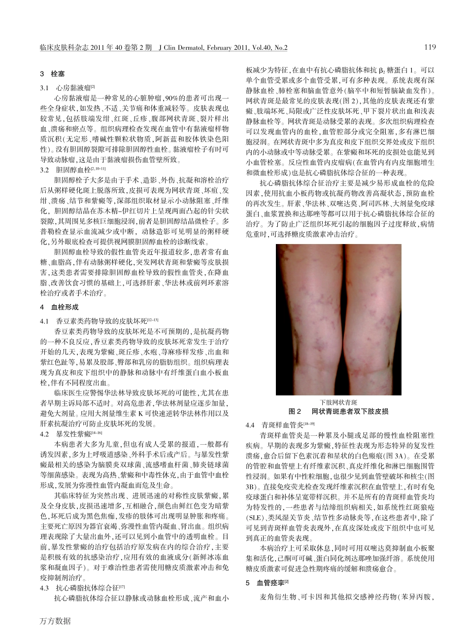 皮肤假性血管炎_第2页