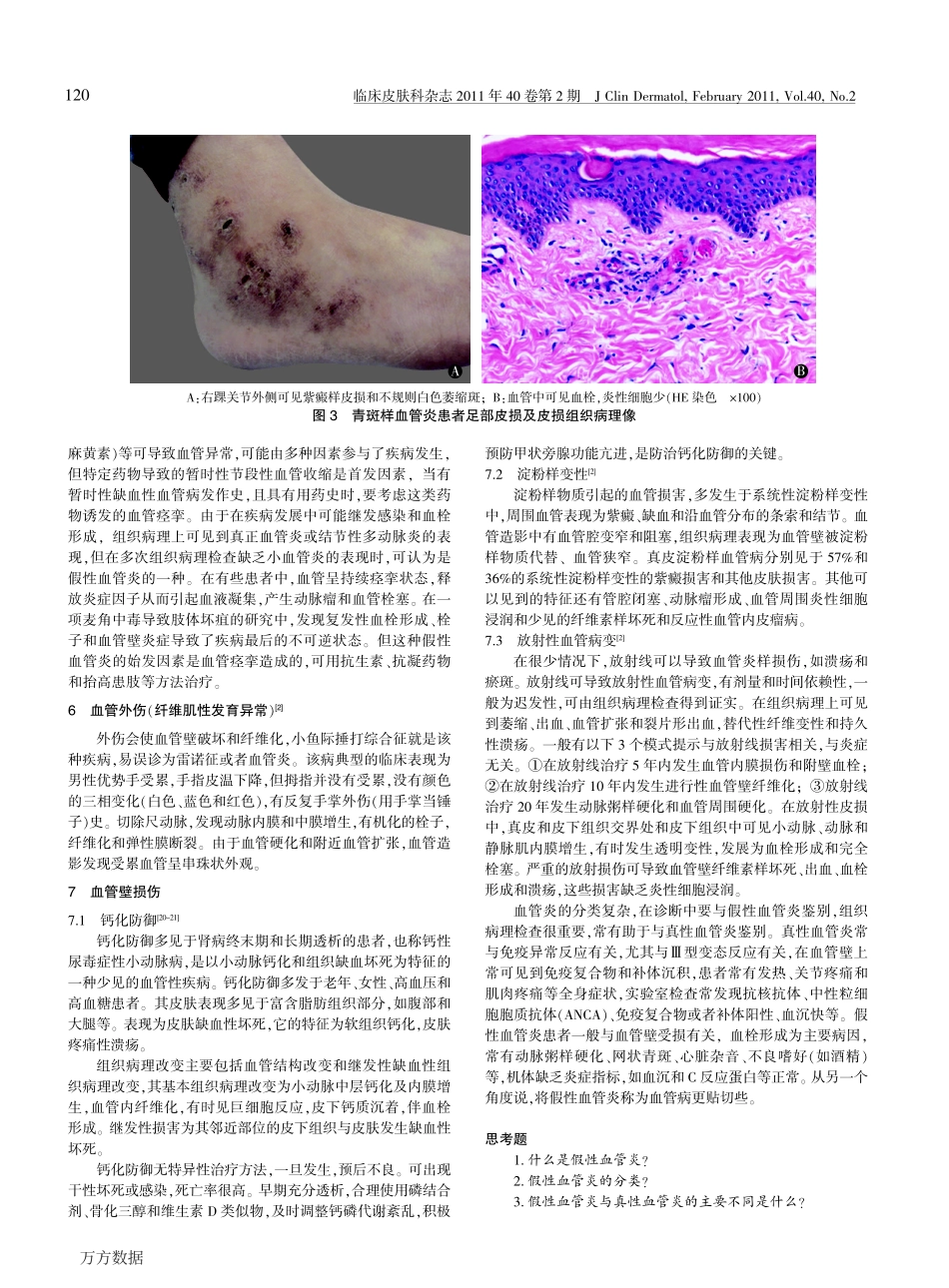 皮肤假性血管炎_第3页