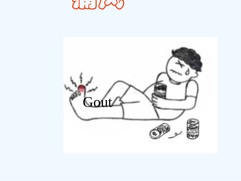痛风ppt副本_第1页