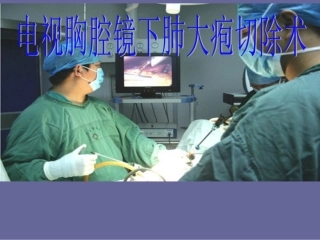 电视胸腔镜下肺大疱2