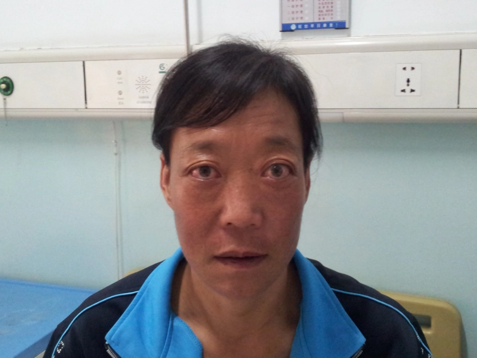 甲状腺功能亢进症(专)_第2页