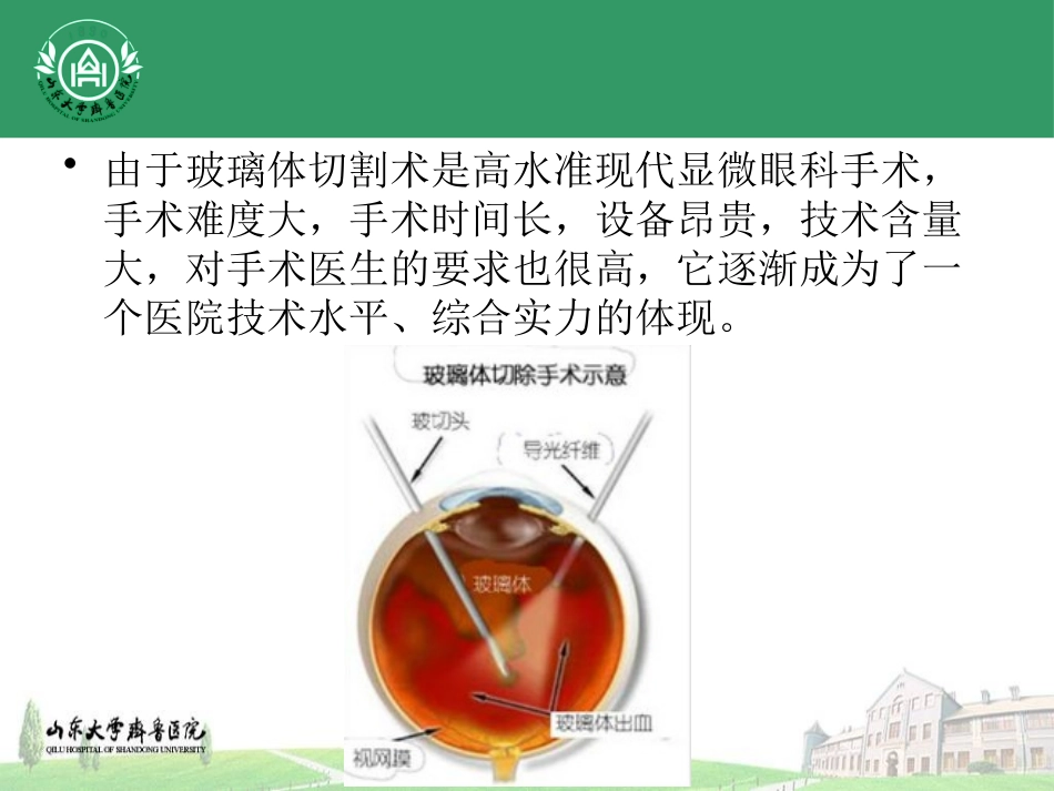 玻璃体切割术适应征_第2页