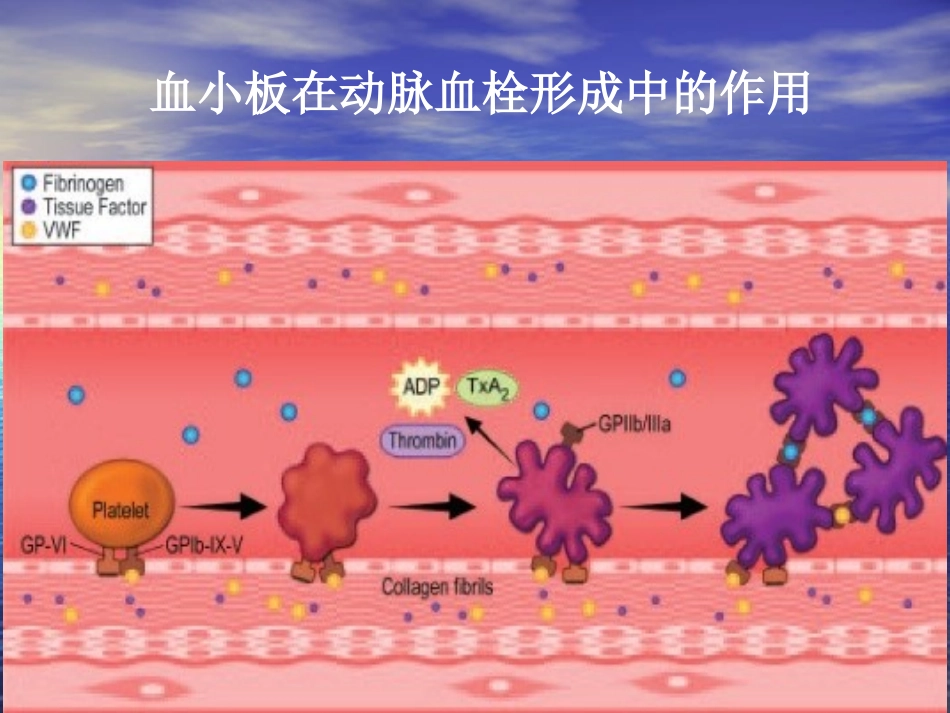 特殊人群的抗血小板治疗-1_第2页