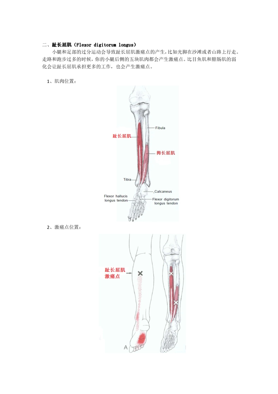 激痛点和肌肉疼痛自我按摩治疗(16)------足弓和足中部痛_第3页