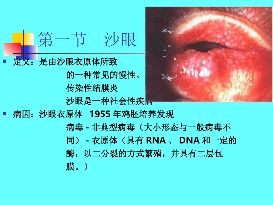 滤泡角膜血管翳_第2页
