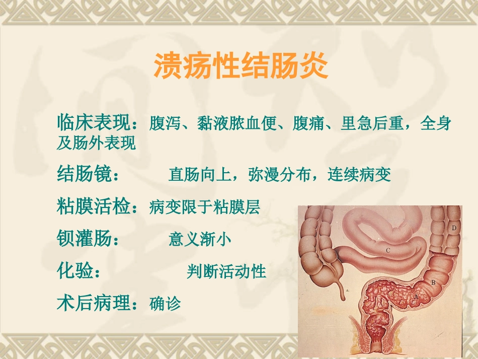 溃疡性结肠炎诊治指南_第3页