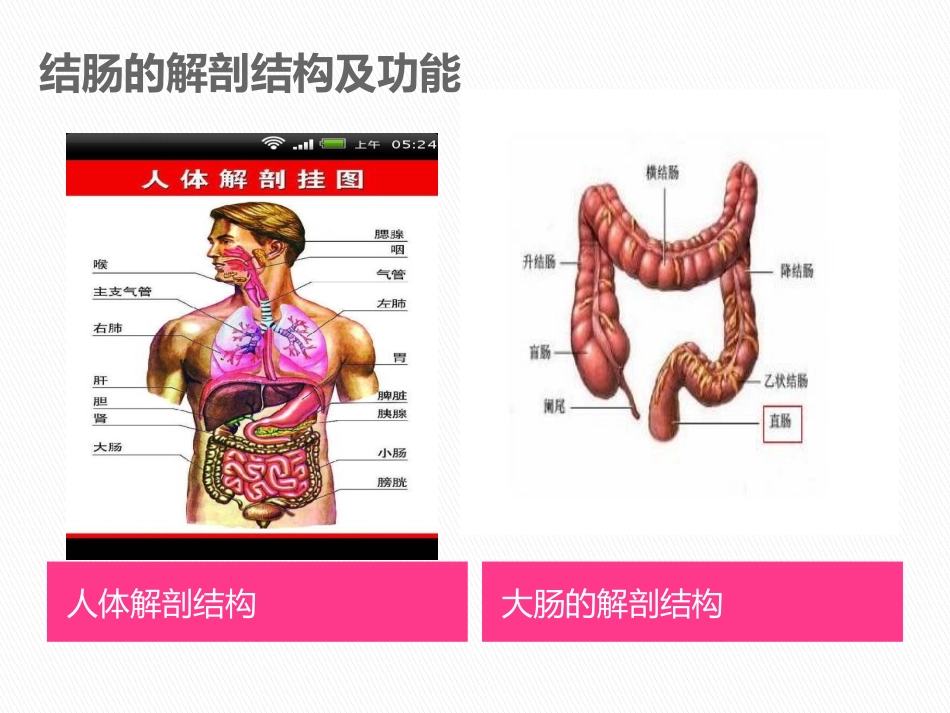 溃疡性结肠炎._第3页