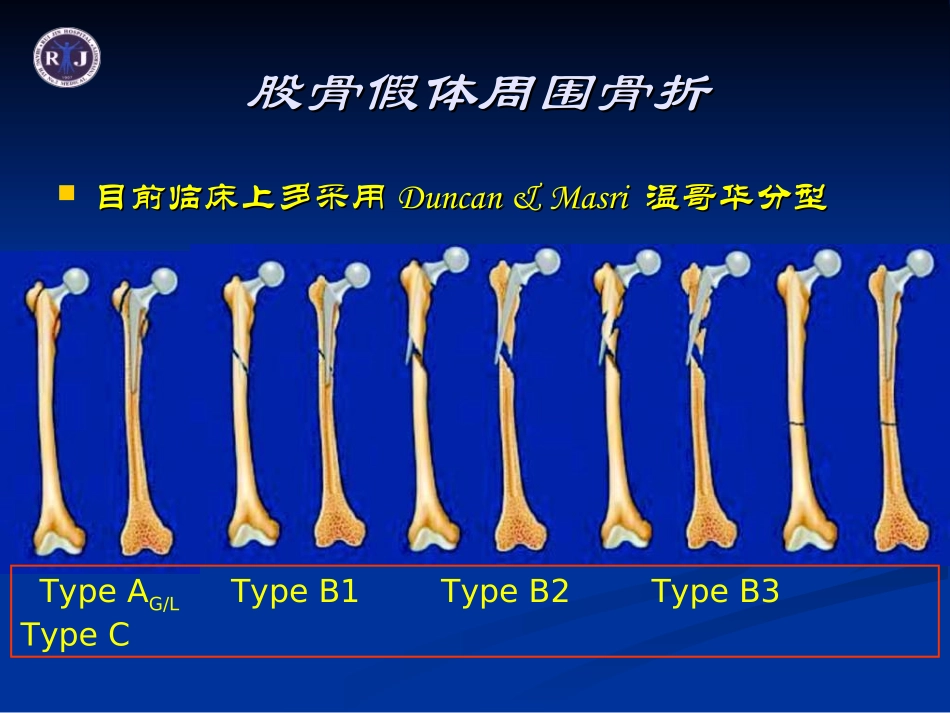 温哥华B3型股骨假体周围骨折_第3页