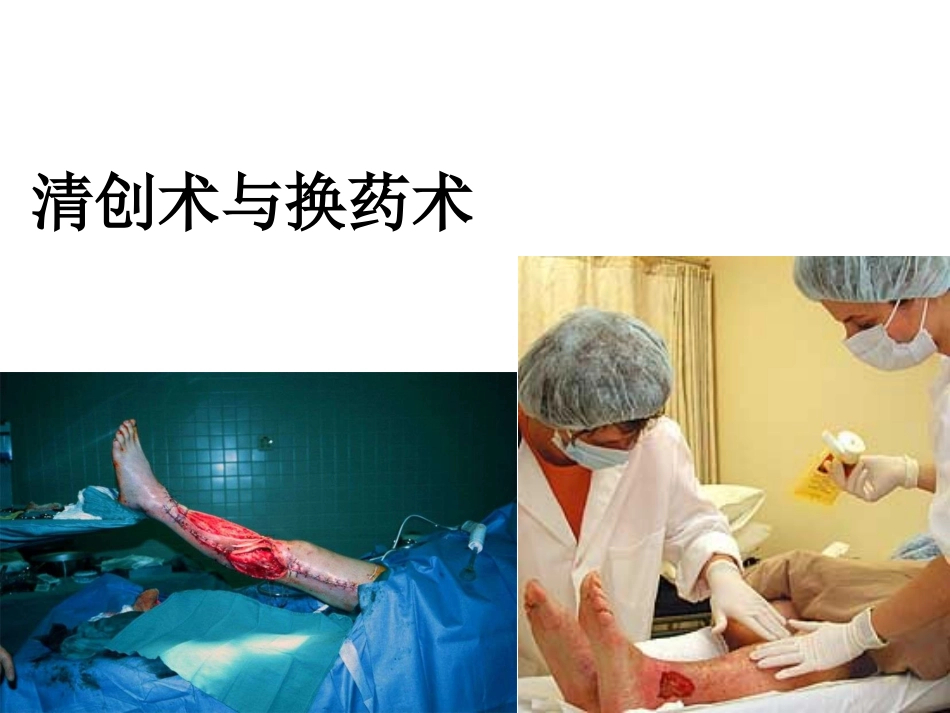 清创术与换药术_第1页