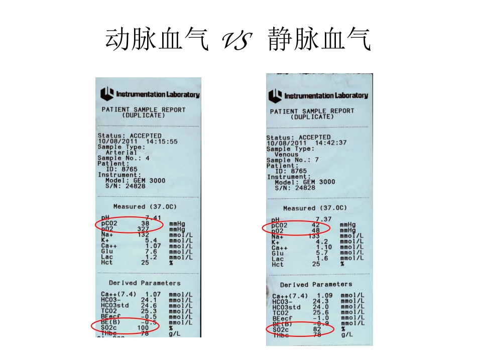 混合静脉血气分析_第2页