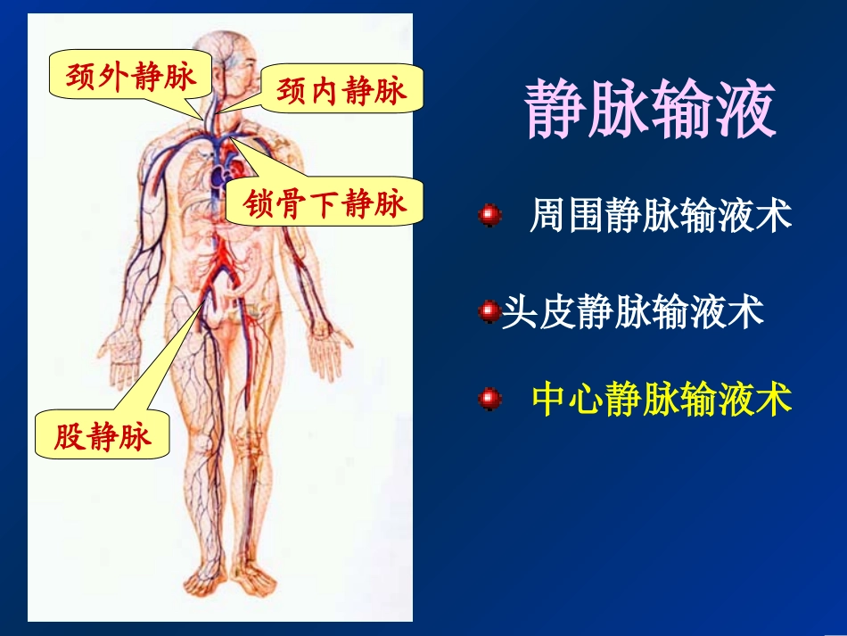 深静脉输液讲义._第2页