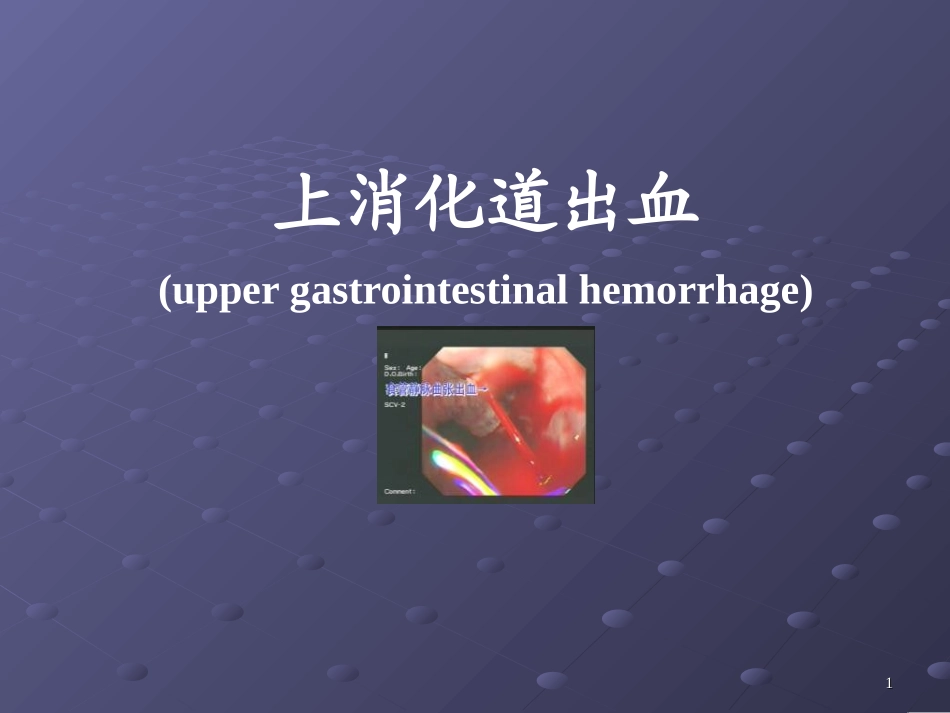 消化道出血讲课用_第1页
