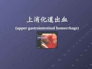 消化道出血讲课用