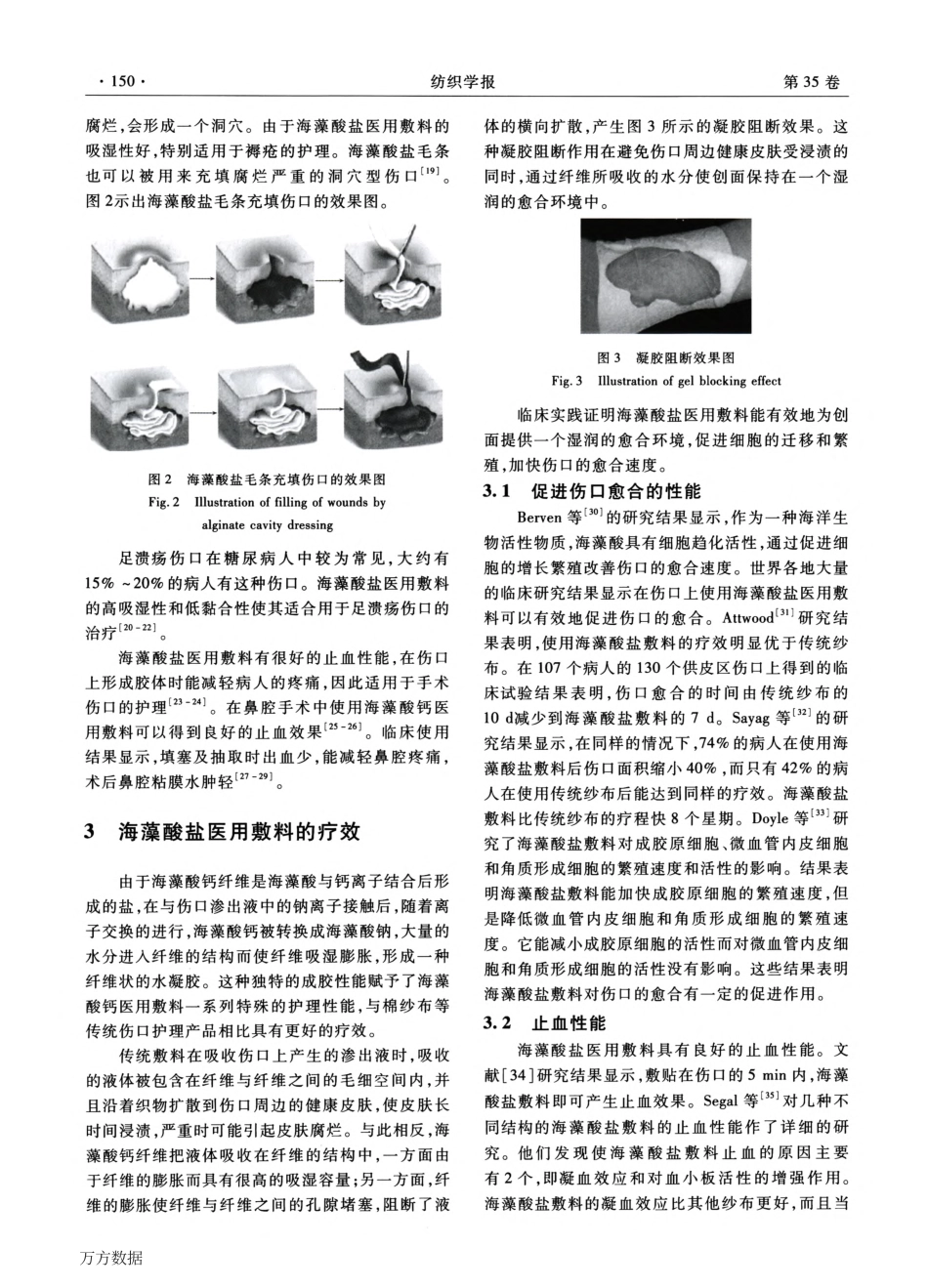 海藻酸盐医用敷料的临床应用_第3页