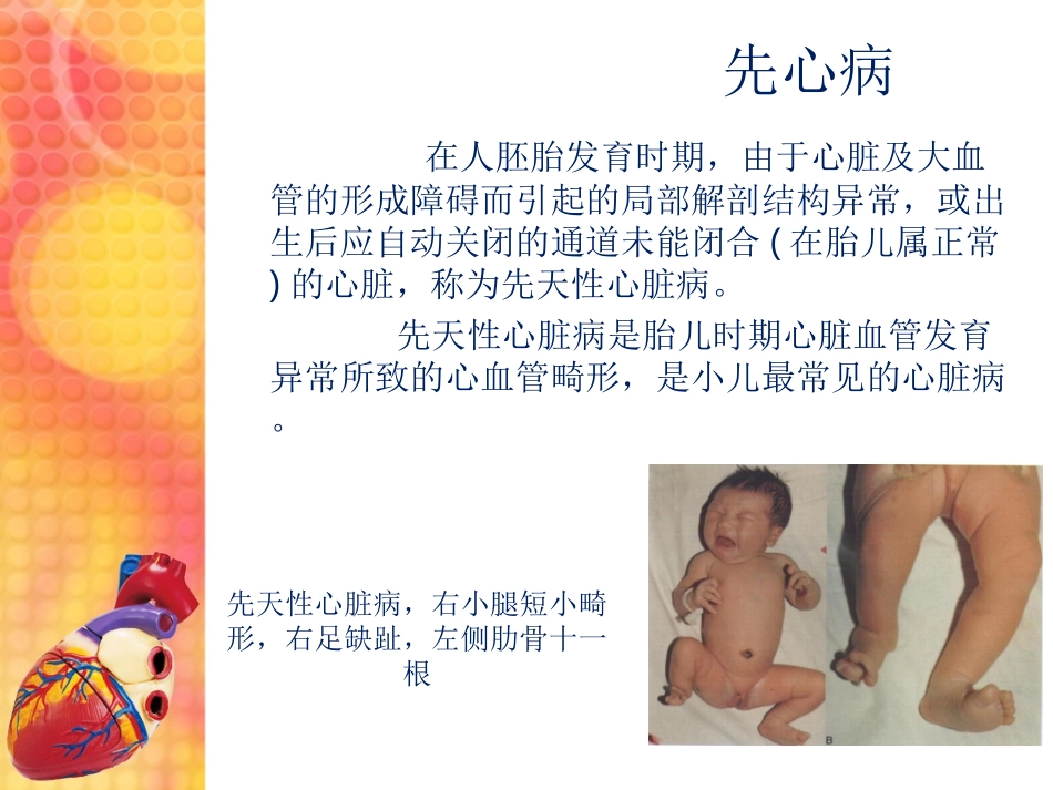 浅谈先天性心脏病(CHD)概要_第3页