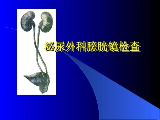 泌尿外科膀胱镜检查