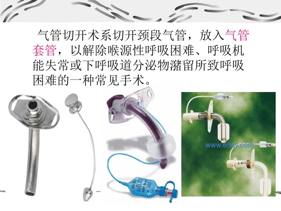 气管切开术.ppt_第2页