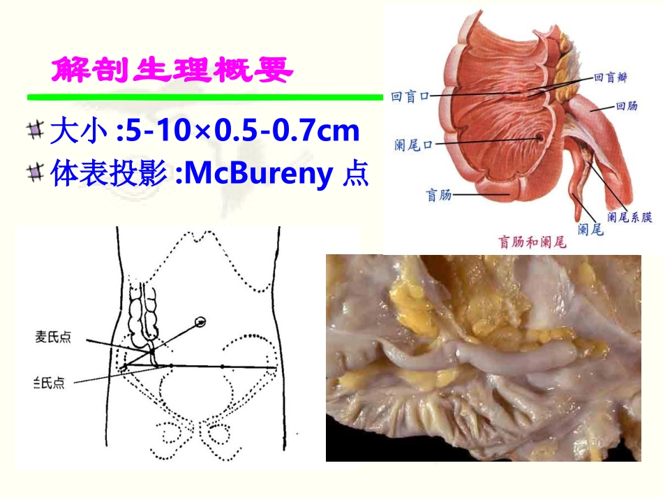 模块二-136阑尾炎_第3页