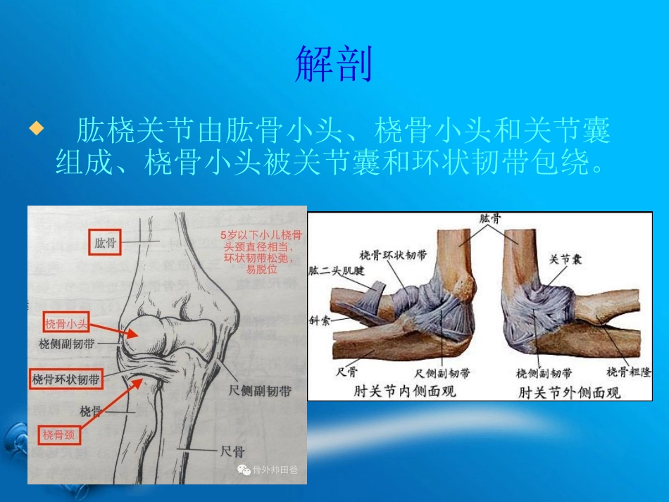 桡骨小头半脱位_第3页