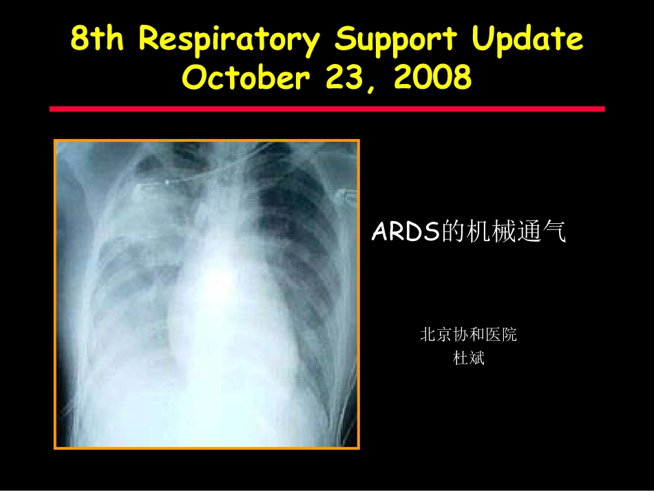 杜斌-ARDS的机械通气_第1页